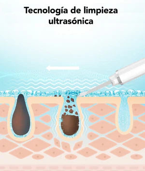 DermaWave – Espátula Facial Ultrasónica para una Piel Radiante y Joven