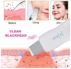 DermaWave – Espátula Facial Ultrasónica para una Piel Radiante y Joven