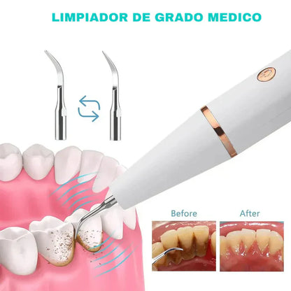 DentalClean ® : Quita Sarro eléctrico con eliminador de placa + cabezal intercambiable