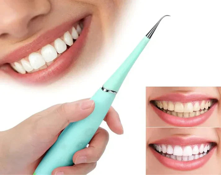 DentalClean ® : Quita Sarro eléctrico con eliminador de placa + cabezal intercambiable