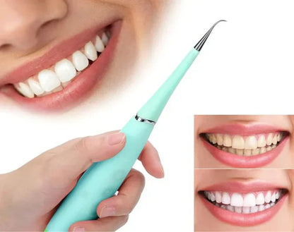 DentalClean ® : Quita Sarro eléctrico con eliminador de placa + cabezal intercambiable