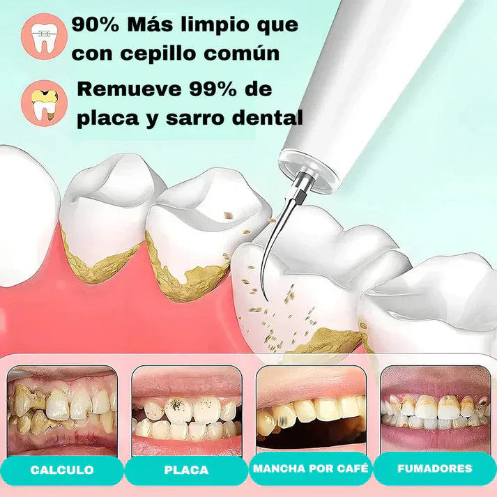 DentalClean ® : Quita Sarro eléctrico con eliminador de placa + cabezal intercambiable