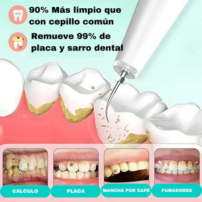 DentalClean ® : Quita Sarro eléctrico con eliminador de placa + cabezal intercambiable